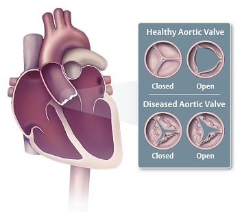 Heart Diagram